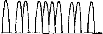 igbt Ӣģһ